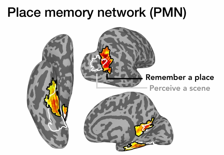 Illustrations of the brain at various angles